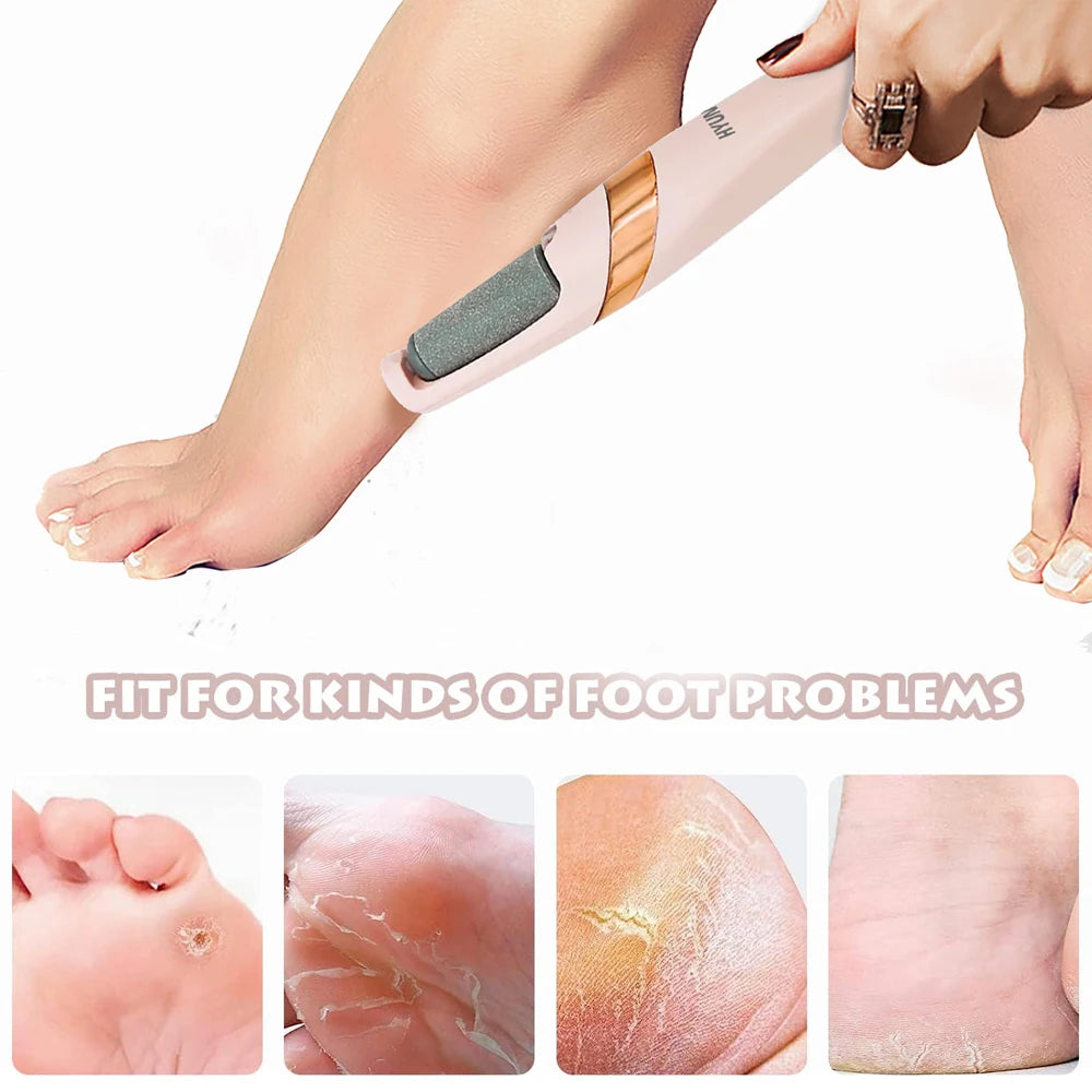 PMS-005 Electric Callus Remover for Feet, Rechargeable Foot File Pedicure Tool, Portable Foot Callus Remover Waterproof Profess